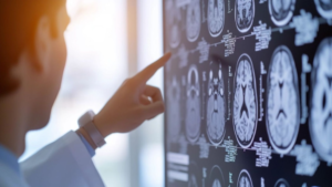5 señales que podrían indicar un accidente cerebrovascular