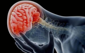 Cómo tu cuerpo puede alertarte sobre un posible derrame cerebral