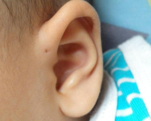 Descubre el origen y significado de esta particular marca en la oreja