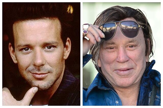 La obsesión de Mickey Rourke con la cirugía estética marcó su carrera