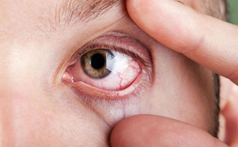 Síntomas poco conocidos de alteraciones en el azúcar en sangre que se manifiestan en los ojos